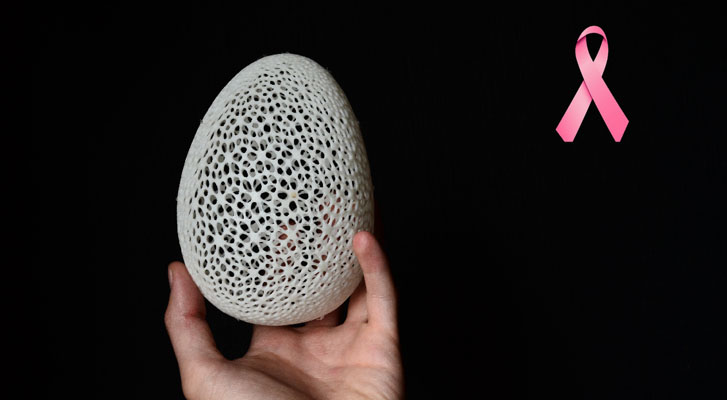 En Proyecto Cali diseñan e imprimen prótesis mamarias en 3D