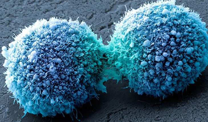 Investigan en Londres nueva cura potencial del cáncer de páncreas mediante “células asesinas”