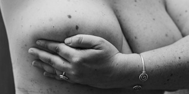 Cáncer de mama: sus números y cómo prevenirlo