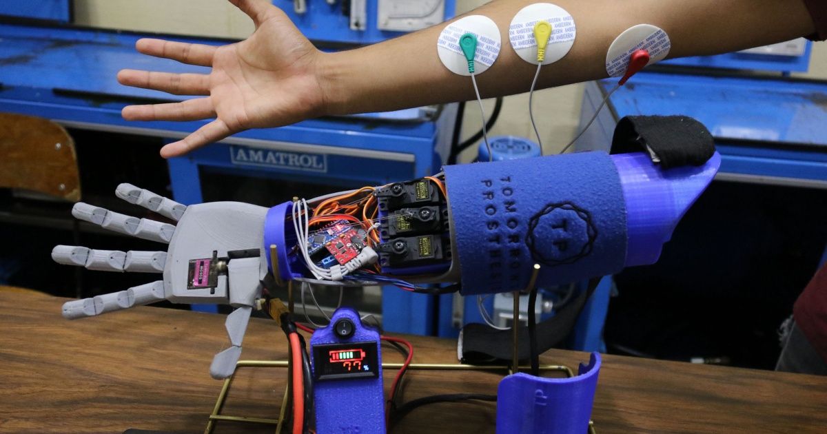 Crean brazo biónico a bajo costo para personas con amputación