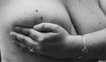 Cáncer de mama: sus números y cómo prevenirlo