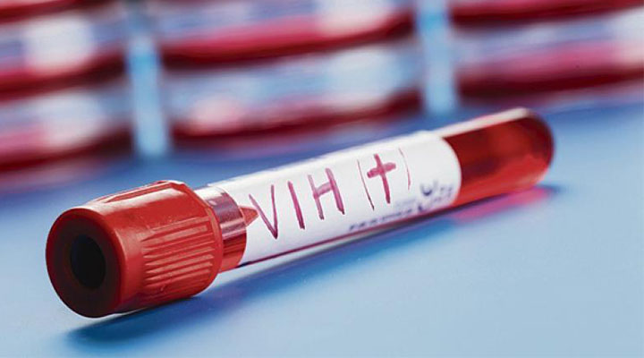 En España, eliminan el VIH en seis pacientes con trasplantes de células madre