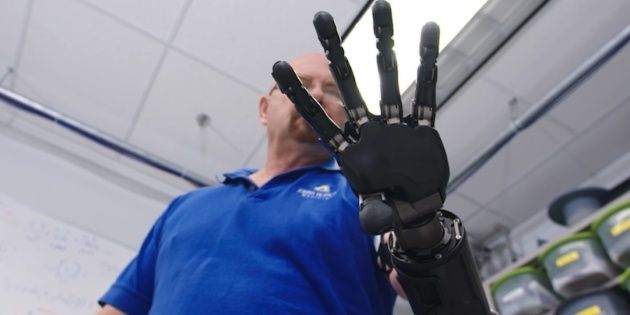 Conocé al hombre que vive con el brazo robótico más avanzado del mundo