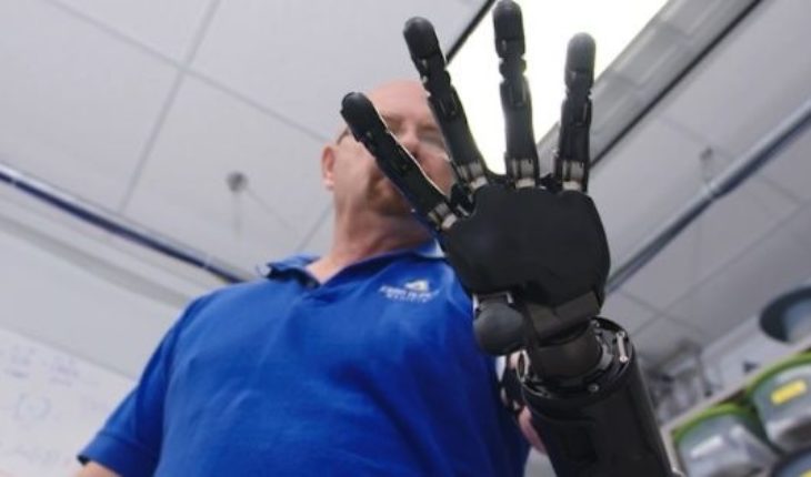 Conocé al hombre que vive con el brazo robótico más avanzado del mundo