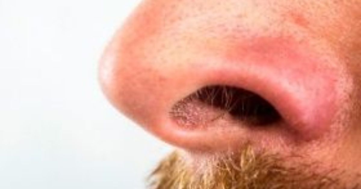 Crean nariz electrónica para detectar diabetes a través del aliento
