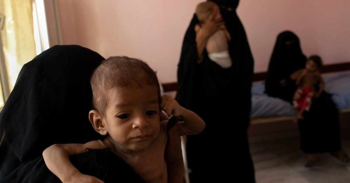En Yemen han muerto al menos 85 mil niños por inanición