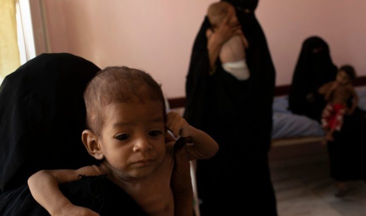 En Yemen han muerto al menos 85 mil niños por inanición