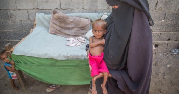 Guerra en Yemen: 85.000 niños han muerto por desnutrición