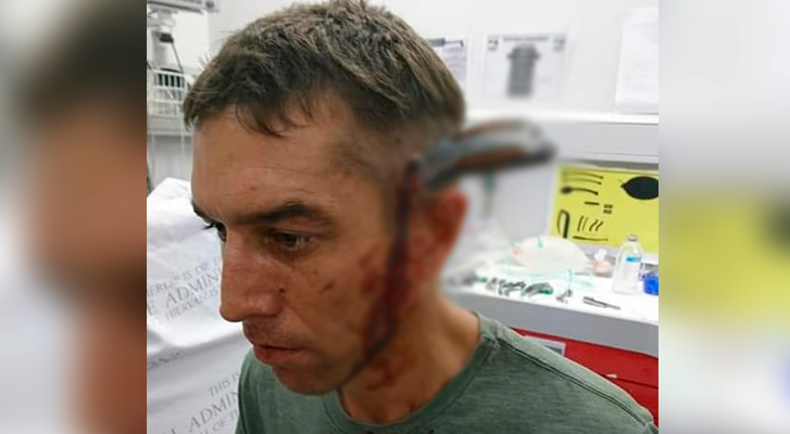 Hombre llega al hospital con un cuchillo en su cabeza y dice "¿Tiene un médico libre?"