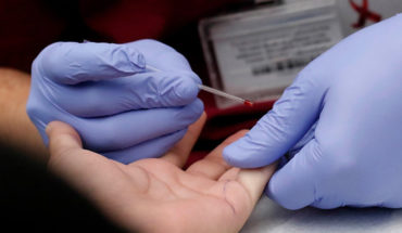 Experta por aumento de contagios: “Chile ha carecido de una política efectiva de prevención del VIH”