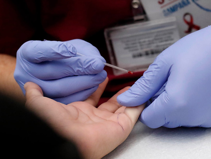 Experta por aumento de contagios: "Chile ha carecido de una política efectiva de prevención del VIH"