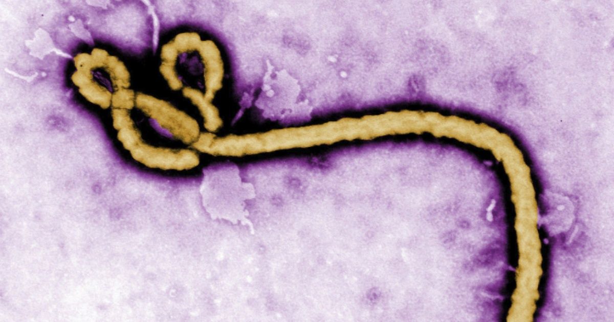Hallan proteína en células humanas para combatir el ebola