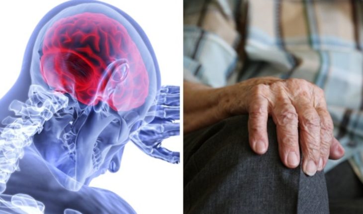 “Marcapasos cerebral” podría tratar epilepsia y párkinson