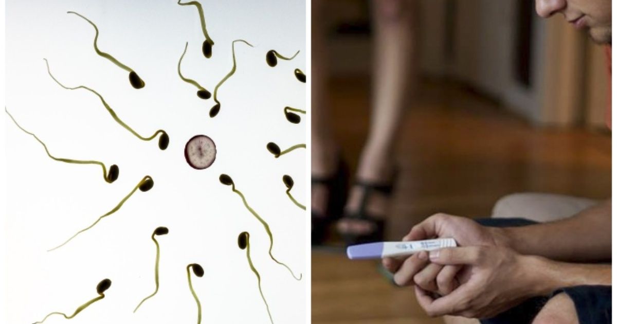 Varicocele, la enfermedad que causa infertilidad en hombres