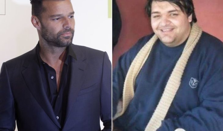 translated from Spanish: Argentino se operó 27 veces para quedar igual a Ricky Martin
