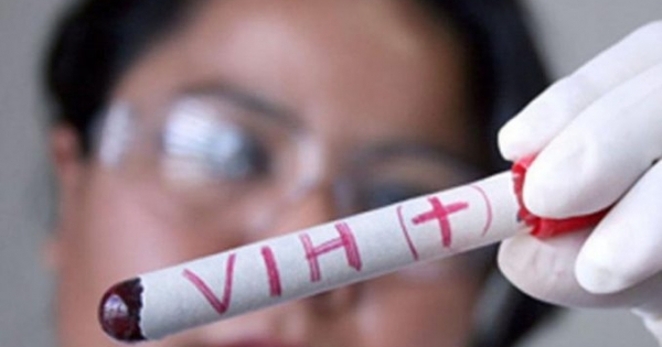 Entre enero y septiembre se han detectado en Chile 3.500 nuevos casos de VIH