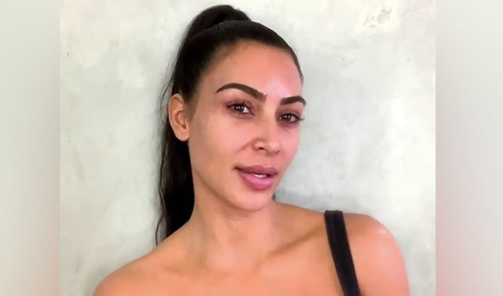 translated from Spanish: Kim Kardashian pide ayuda a sus fans, dice que la psoriasis se ha apoderado de su cuerpo y admite que el maquillaje no lo puede cubrir