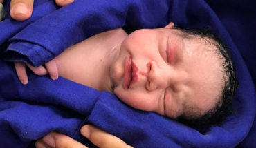 The first baby is born in Brazil after a transplant of uterus of a corpse