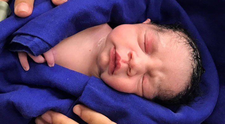 The first baby is born in Brazil after a transplant of uterus of a corpse