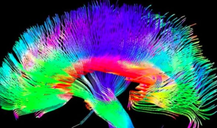 Mapean zona del cerebro donde ocurre la toma de conciencia