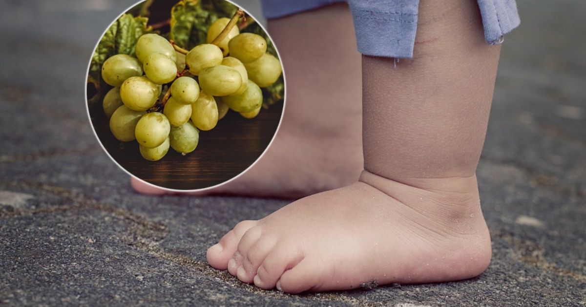 Child dies choking with a grape in new year