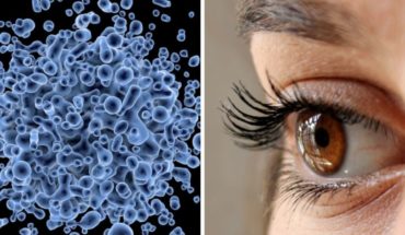 Como prevenir y tratar las alergias de los ojos