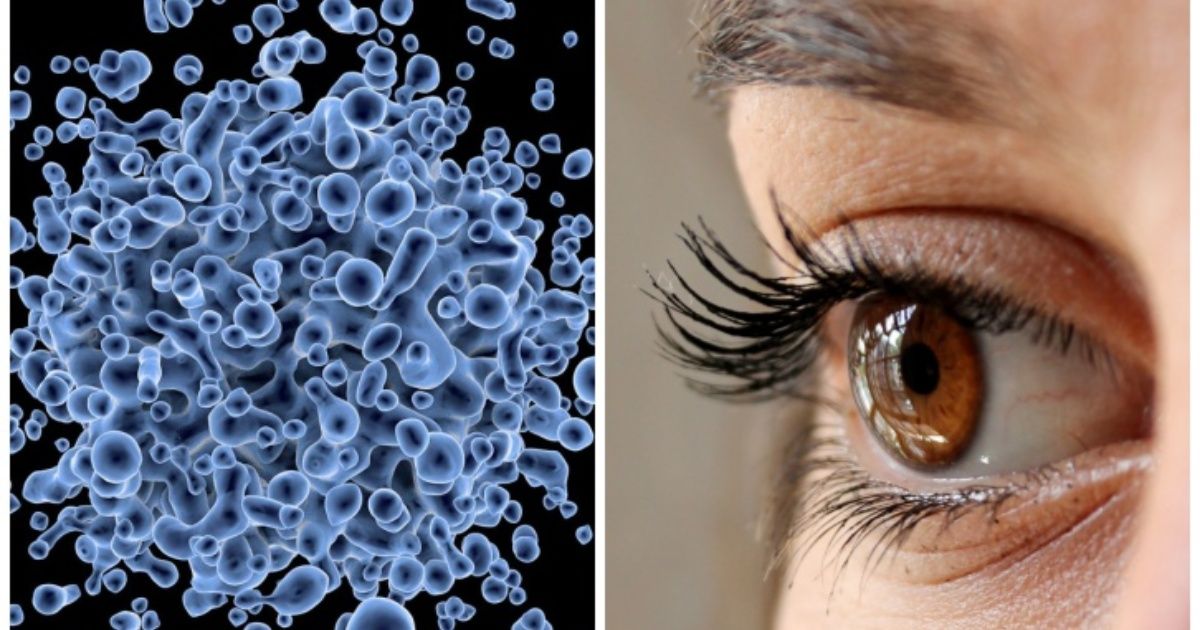 Como prevenir y tratar las alergias de los ojos