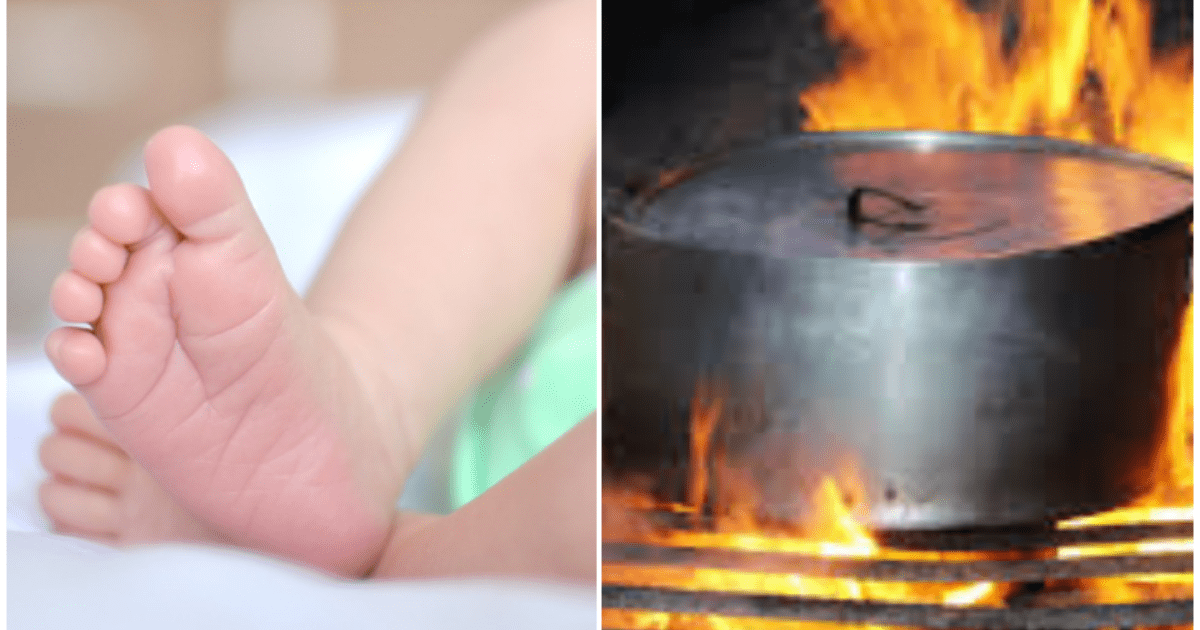 Abuela arroja agua hirviendo a su yerno y quema a bebé