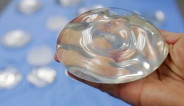 EEUU: Expertos recomiendan no prohibir implantes mamarios