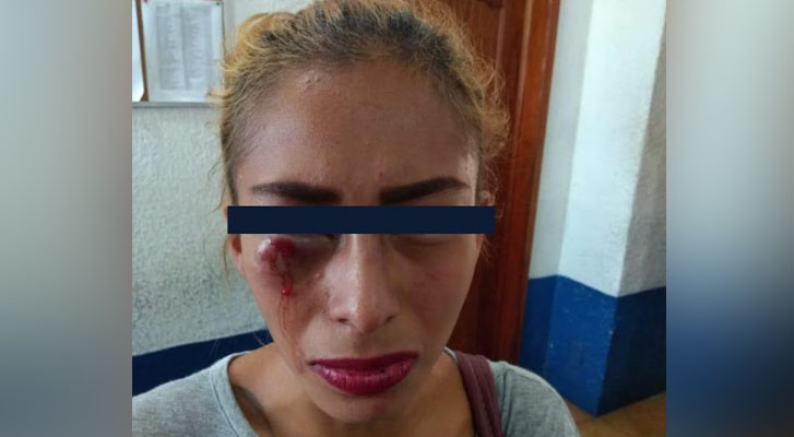 En Veracruz, una mujer que denunció a su pareja por golpeador, ahora teme por su vida, ya que la Fiscalía dejó en libertad al agresor
