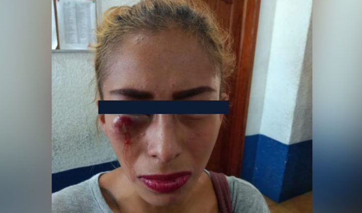 En Veracruz, una mujer que denunció a su pareja por golpeador, ahora teme por su vida, ya que la Fiscalía dejó en libertad al agresor
