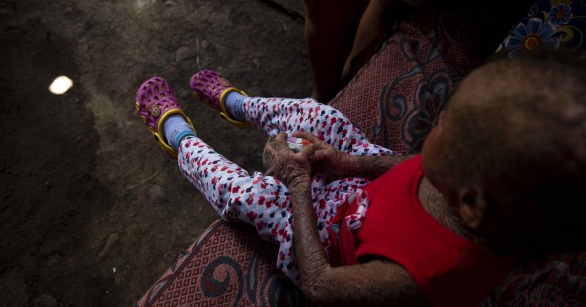 Una oportunidad para Milagros, la niña "piel de pescado" de Nicaragua