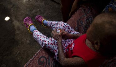 Una oportunidad para Milagros, la niña "piel de pescado" de Nicaragua