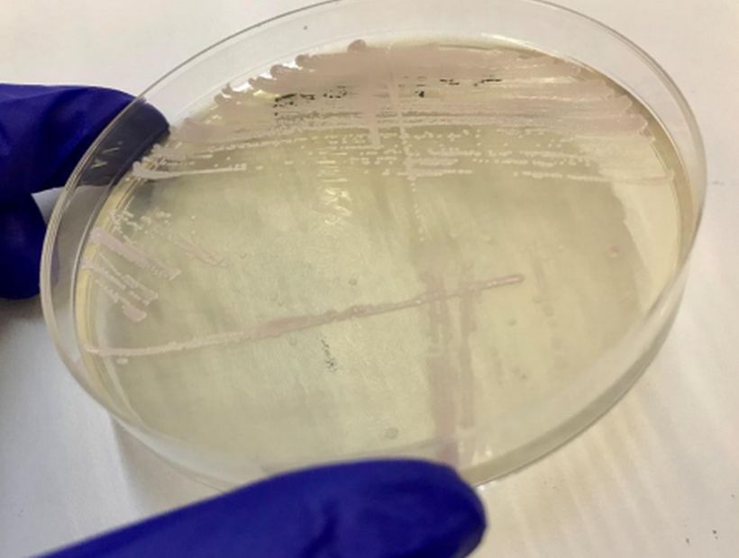 Detectan primera “superbacteria” en Chile en Hospital del Salvador