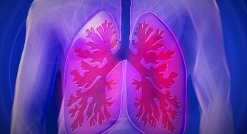 translated from Spanish: Do you have cough and feel lack of air and difficulty breathing? It can be idiopathic pulmonary fibrosis