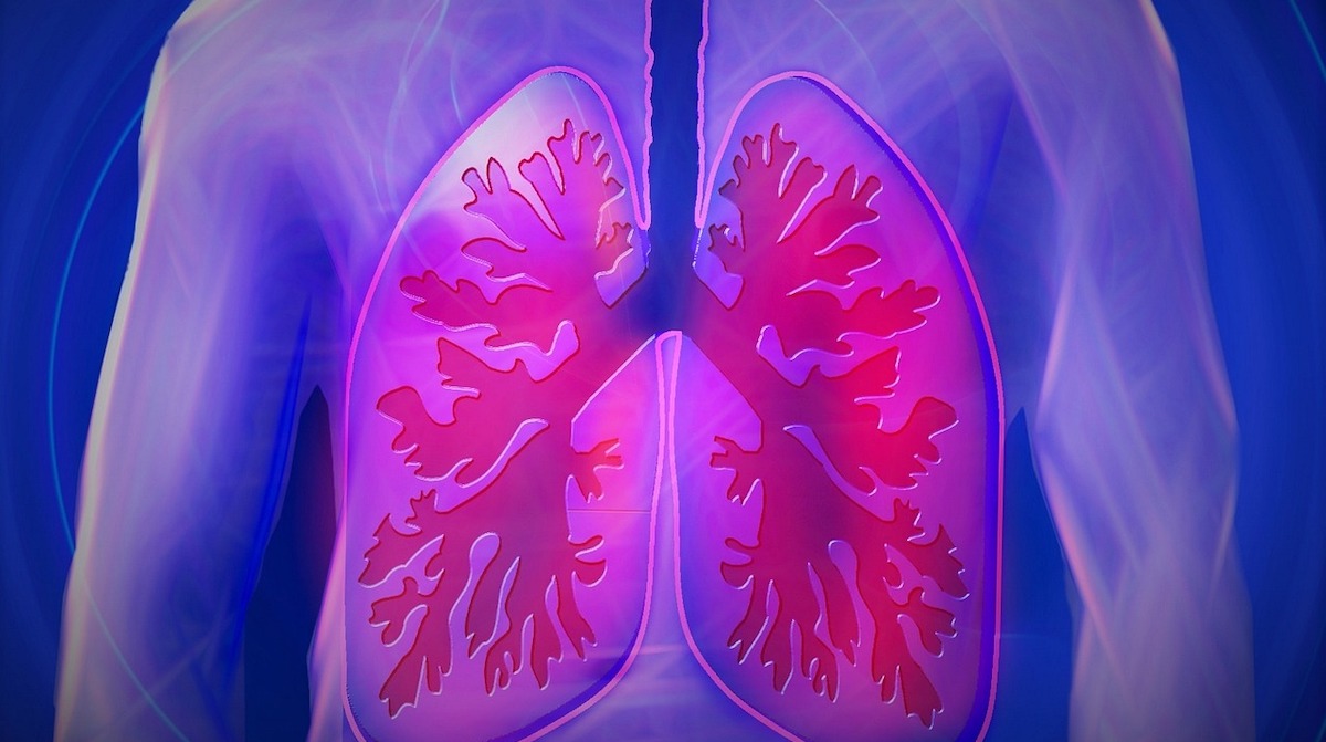 Do you have cough and feel lack of air and difficulty breathing? It can be idiopathic pulmonary fibrosis