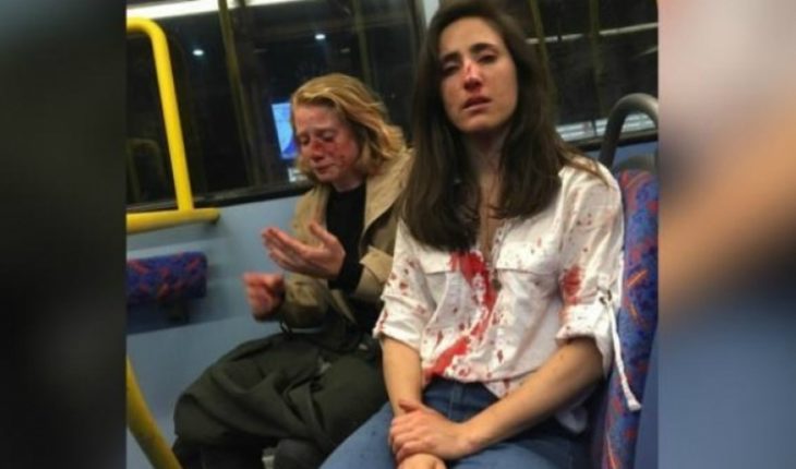 Detienen a sospechosos de ataque lesbofóbico abordo de un autobús