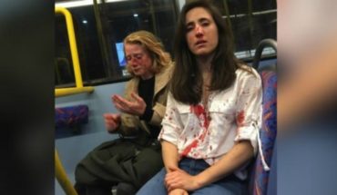 Sospechos de ataque lesbofóbico a bordo de autobús fueron liberados bajo fianza