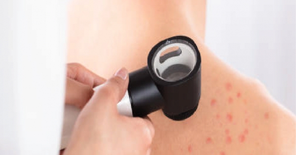 Chilean therapy against melanoma and prostate cancer will be tested in Brazil