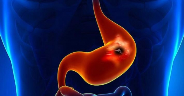 World Stomach Day: 3,000 people die each year from gastric cancer in Chile