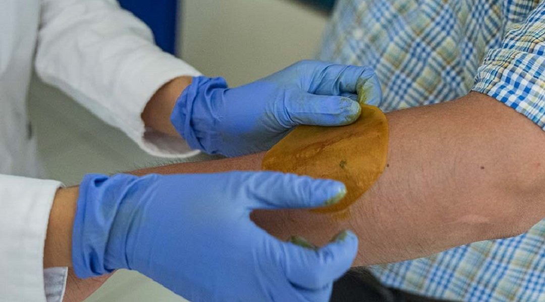 UNAM creates a patch to regenerate diabetic skin quickly