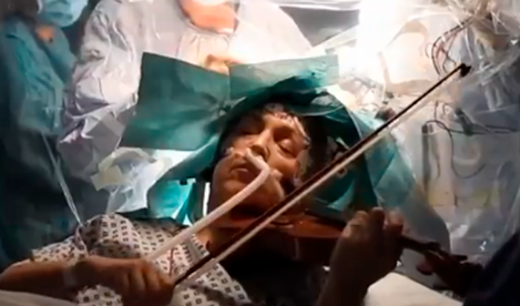Mujer tocó el violín durante una cirugía para extirparle un tumor cerebral (Video)