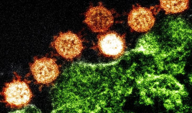 translated from Spanish: How does coronavirus infect human cells?