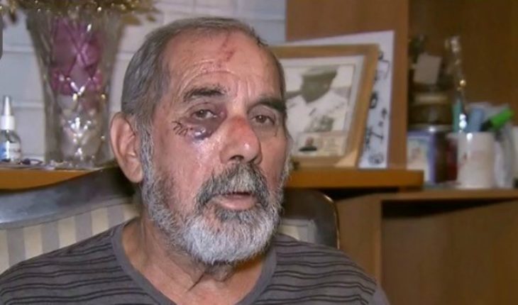 translated from Spanish: Older adult who was assaulted by Carabineros: “I tried to defend myself but it was impossible to avoid it”