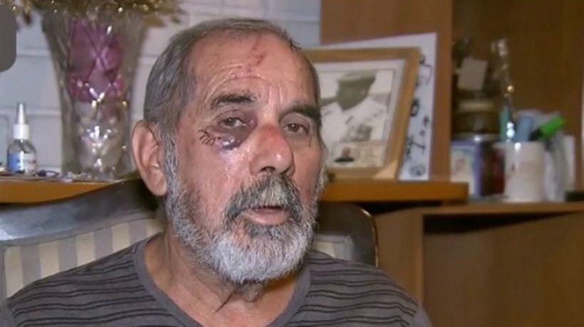 Older adult who was assaulted by Carabineros: "I tried to defend myself but it was impossible to avoid it"