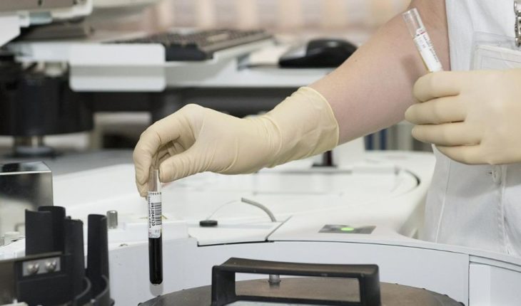 Las pruebas de una vacuna contra COVID-19 en Oxford pueden acabar en agosto