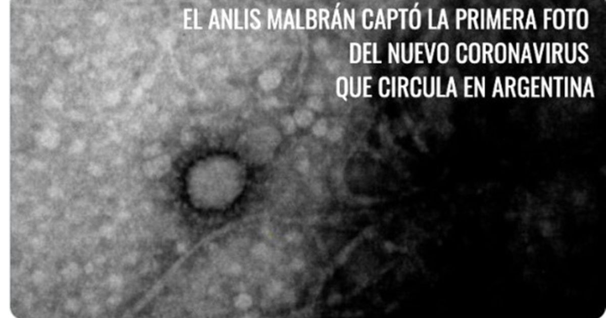 The first photo of the new coronavirus circulating in Argentina