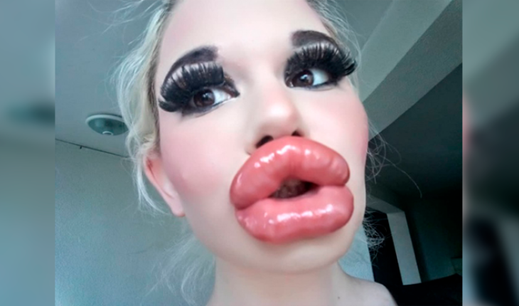 ‘Barbie humana’; mujer famosa por sus grandes labios (Video)