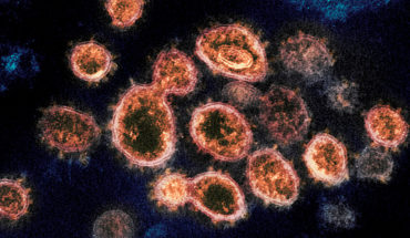 Imagen del SARS-CoV-2 (el virus causante de la pandemia del COVID-19). Foto: NIH Image Gallery / NIAID-RML (Dominio público). Blog Elcano