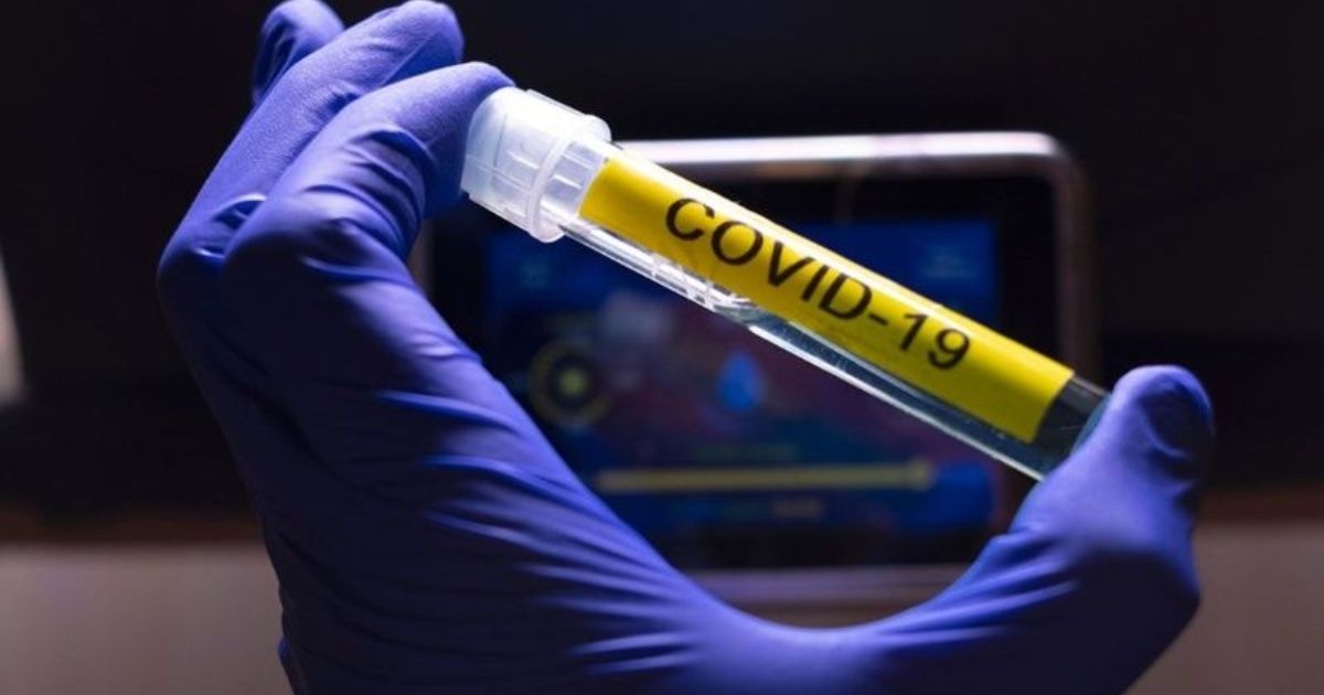 Coronavirus: hubo 1.531 nuevos casos y 30 muertes en las últimas 24 horas